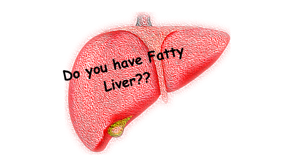 Fatty Liver