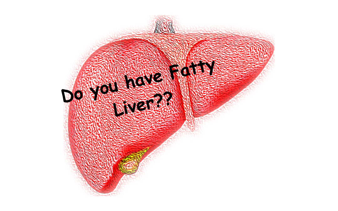 Fatty Liver